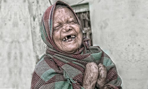 Webastrologers Dream Dictionary Leprosy Disease Dreams