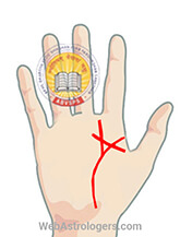 Hand Image