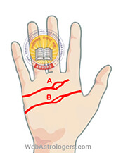 Hand Image