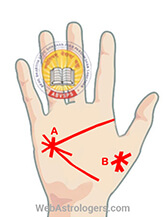 Hand Image