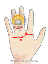 Hand Image